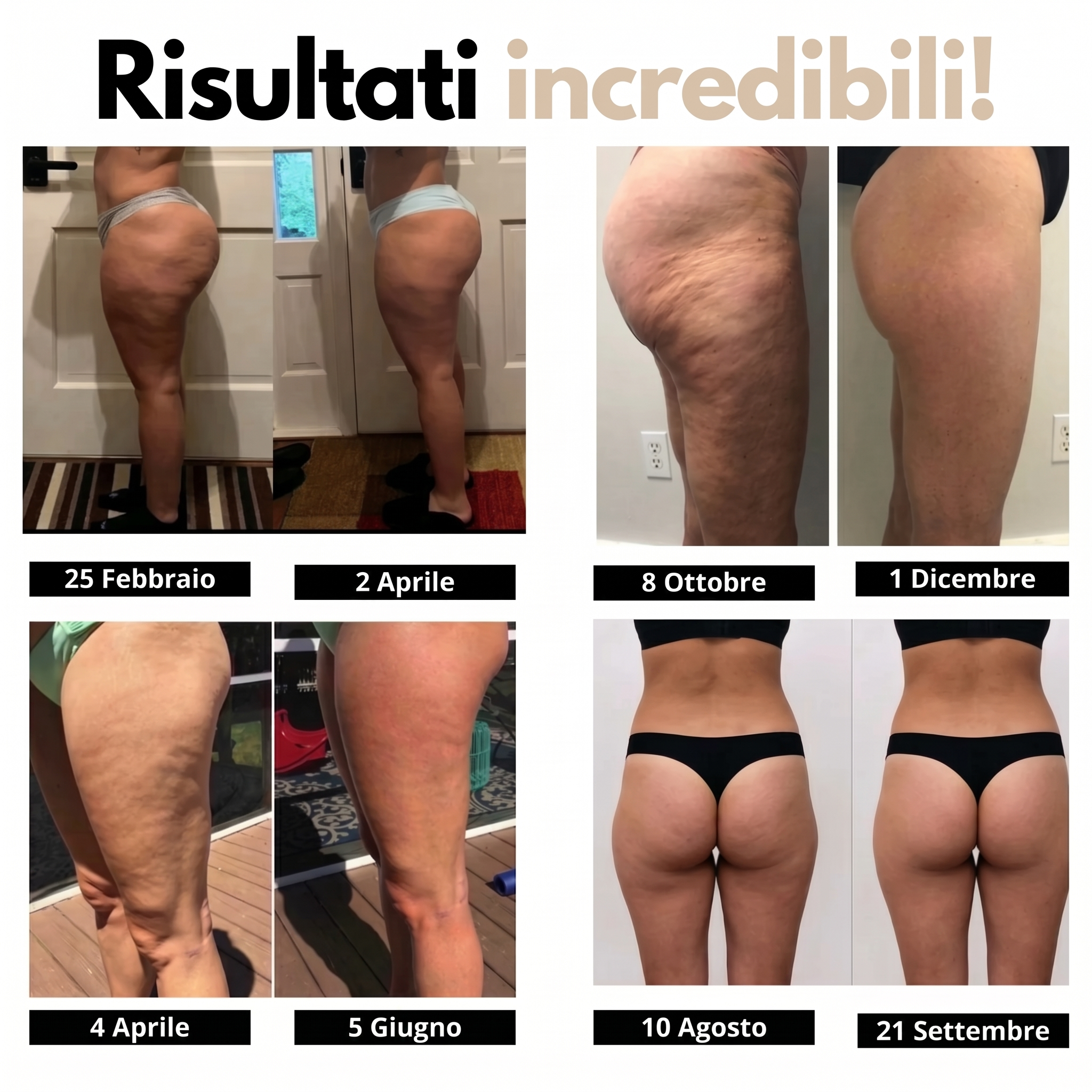 Leggings 3D Lynaye – Ridefinisci la tua silhouette senza sforzo