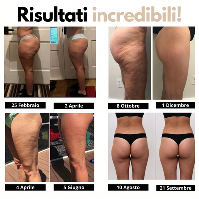 Leggings 3D Lynaye – Ridefinisci la tua silhouette senza sforzo