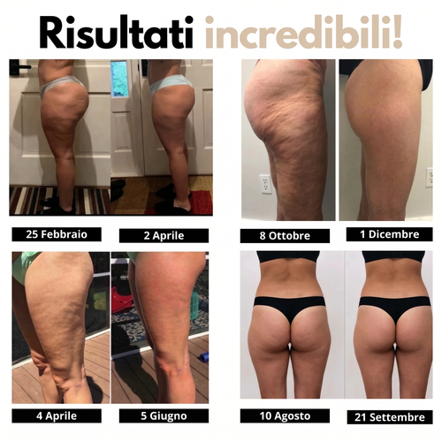 Leggings 3D Lynaye – Ridefinisci la tua silhouette senza sforzo